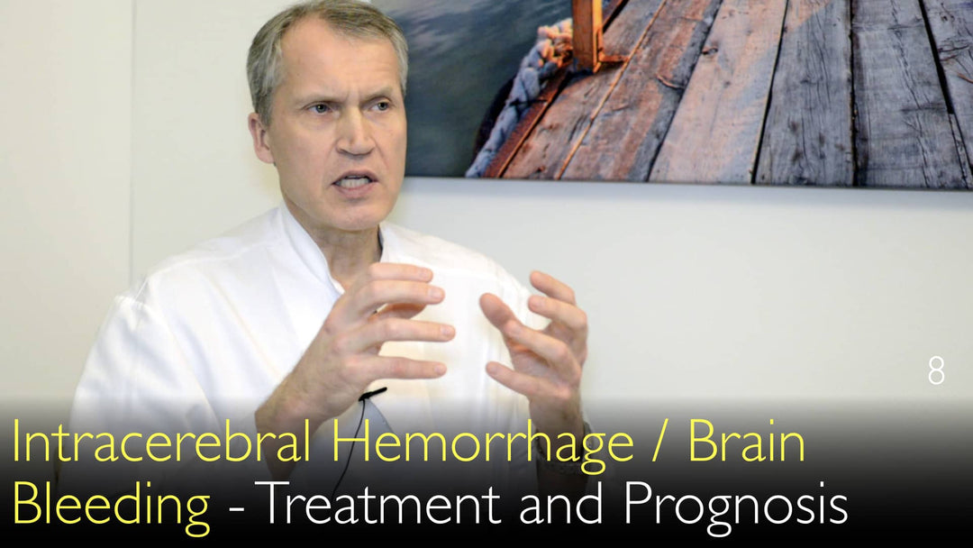 Intracerebral blödning: Behandling och prognos 
 Här följer en översikt över behandlingsalternativ och prognos vid hjärnblödning.