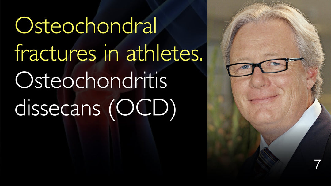 Osteokondrala frakturer hos idrottare. OCD, Osteokondrit dissekans. 7