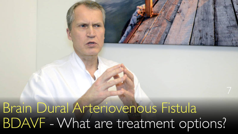 Brain Dural Arteriovenous Fistula. BDAVF. What are treatment options? 7