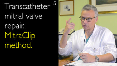 Transcatheter mitral valve repair. MitraClip method. 5