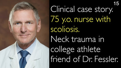 Clinical case story. 75 y.o. nurse with scoliosis. Neck trauma in college athlete friend of Dr. Fessler. 15
